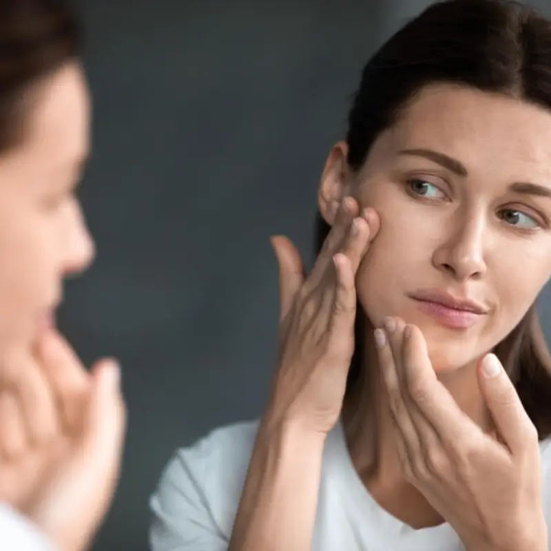 dry dehydrated skin
