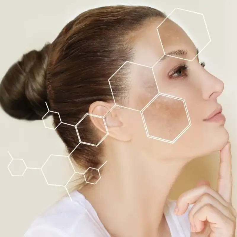 skin pigmentation